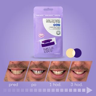 A tvoj výsledok? 🪄 Ak ich ešte nemáš, teraz máš šancu si ich objednať v black friday zľave. Doskladníme ich 12.12.2025....